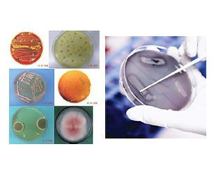AXIMA Sistema de Identificação de Microorganismos