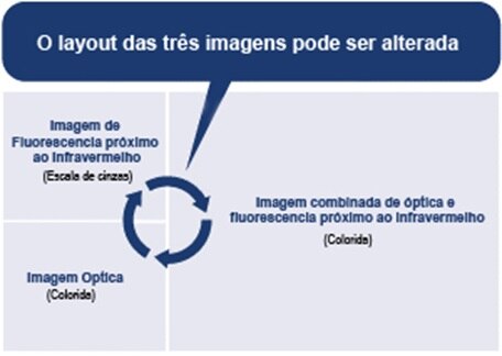 LIGHTVISION